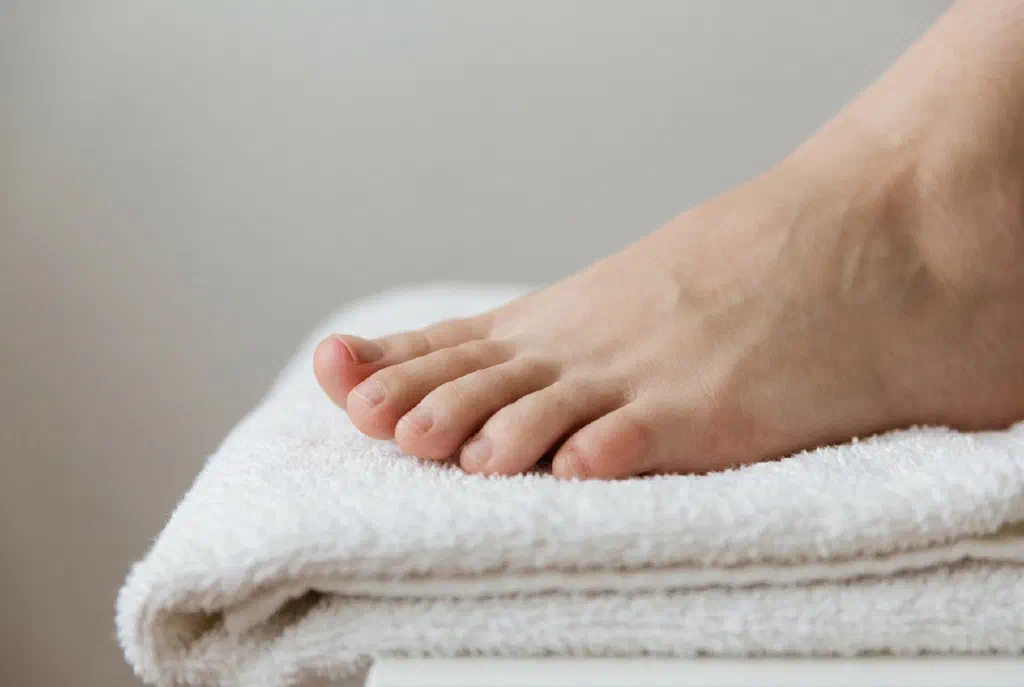 Cận cảnh ngón chân cái bị đỏ với móng mọc quặp vào trong
